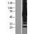Western Blot: SQSTM1 Lysate [NBL1-16446] - Western Blot experiments. 
Left-Control; Right -Over-expression Lysate for SQSTM1